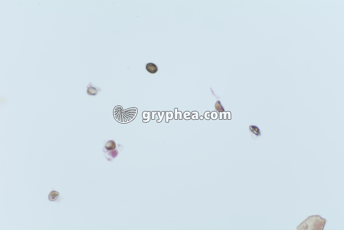 Taenia saginata, oeufs dans déjections x40 - gryphea.org